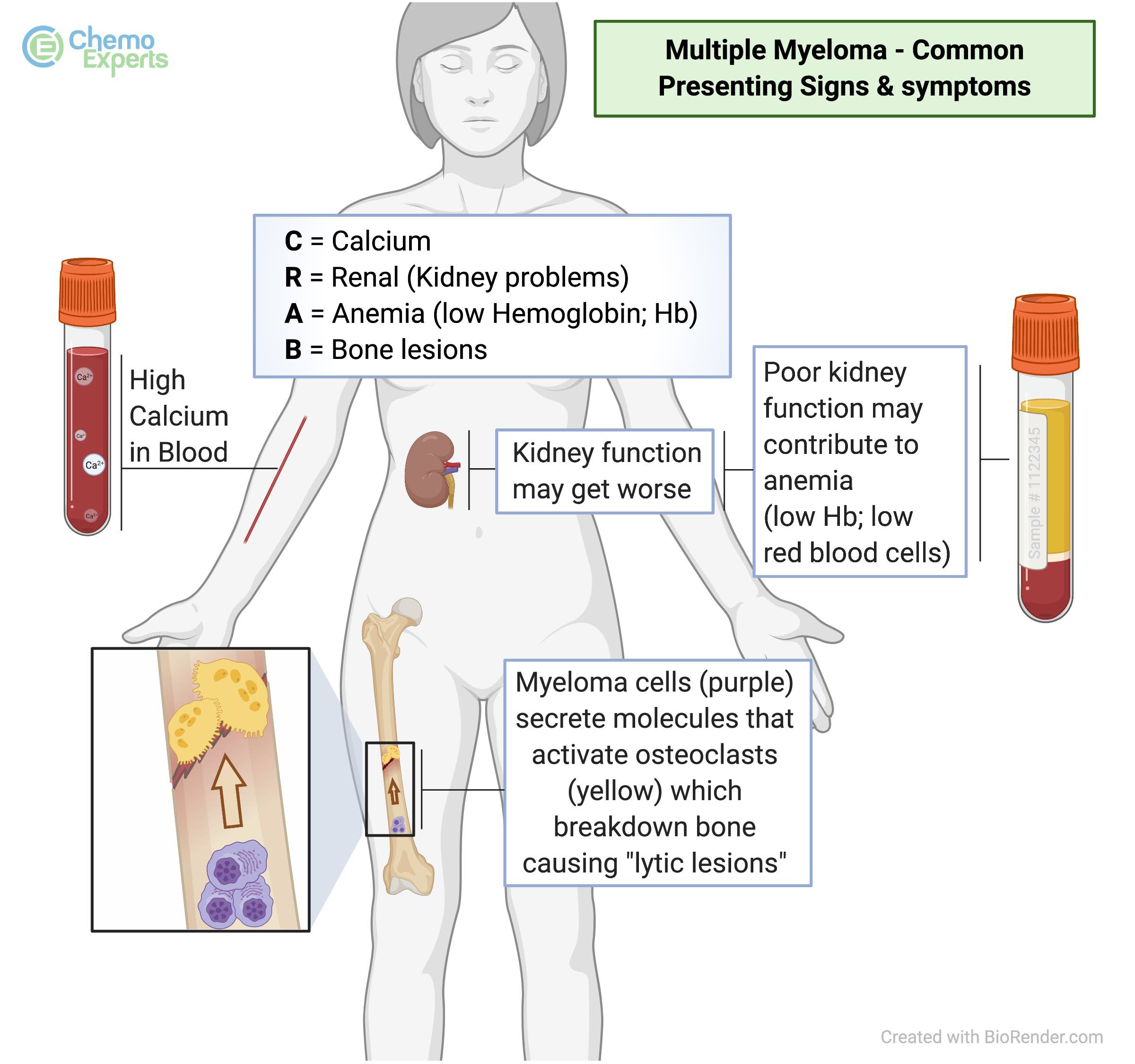 Multiple myeloma commonly affects the following body parts: bone, blood, and kidneys